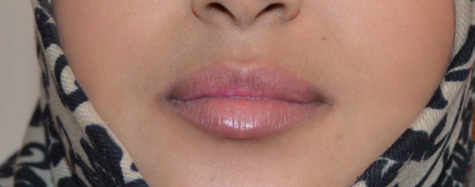 August Lips 2 Before