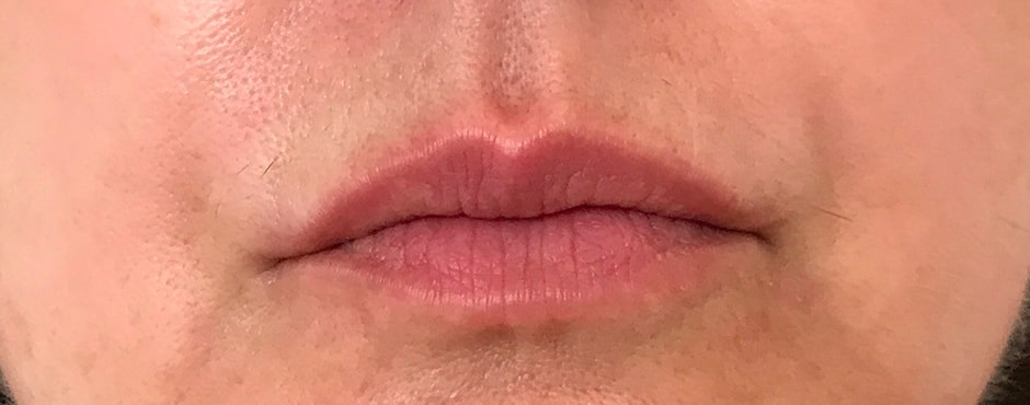 Sian Dellar Portfolio Lips 9 Before